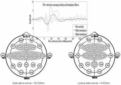 The Effects of Anesthetics on the Cortex—Lessons From Event-Related Potentials